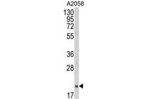 Western blot analysis of FTH1 Antibody (C-term) in A2058 cell line lysates (35 µg/lane). (FTH1 抗体  (C-Term, Heavy Chain))