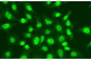 Immunofluorescence analysis of A549 cells using LIG1 Polyclonal Antibody (LIG1 抗体)