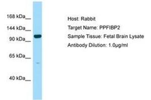 Image no. 1 for anti-Liprin-beta-2 (PPFIBP2) (AA 760-809) antibody (ABIN6750129) (PPFIBP2 抗体  (AA 760-809))