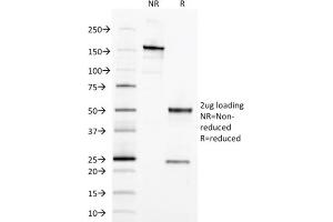 SDS-PAGE Analysis Purified EpCAM Mouse Monoclonal Antibody (EGP40/1373).
