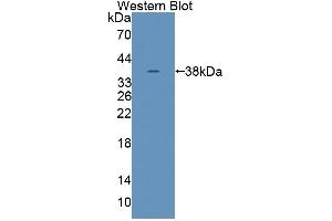 Detection of Recombinant TNS1, Human using Polyclonal Antibody to Tensin 1 (TNS1) (Tensin 1 抗体  (AA 4-307))