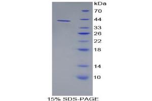 SDS-PAGE analysis of Human AMY1 Protein. (Alpha-amylase 1 蛋白)