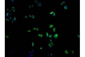Immunofluorescence (IF) image for anti-Olfactory Receptor, Family 1, Subfamily K, Member 1 (OR1K1) (AA 261-273) antibody (ABIN7139968)