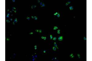 Immunofluorescence staining of Hela cells with ABIN7139968 at 1:100, counter-stained with DAPI. (OR1K1 抗体  (AA 261-273))
