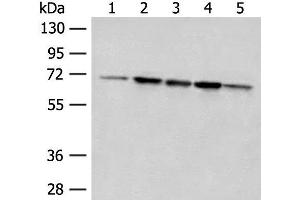 Western blot analysis of 293T cell Rat liver tissue A172 and Jurkat cell lysates using ACSF2 Polyclonal Antibody at dilution of 1:400 (ACSF2 抗体)