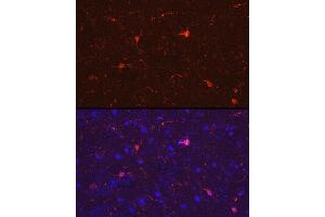 Immunofluorescence analysis of rat brain cells using /IB Rabbit pAb (2391) at dilution of 1:50 (40x lens). (Iba1 抗体  (AA 1-147))