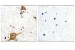 Immunohistochemical analysis of paraffin-embedded human brain tissue using NRG1 isoform-10 antibody. (Neuregulin 1 抗体  (Isoform 10))