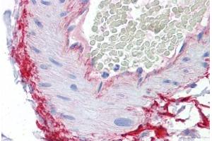 Human Vessel: Formalin-Fixed, Paraffin-Embedded (FFPE) (ROCK2 抗体  (AA 1279-1389))