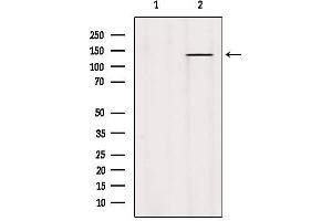 Western blot analysis of extracts from Hybridoma cells, using PTPRO Antibody. (PTPRU 抗体  (Internal Region))