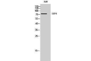 Western Blotting (WB) image for anti-Guanylate Binding Protein 4 (GBP4) (C-Term) antibody (ABIN3184759) (GBP4 抗体  (C-Term))