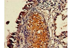 Immunohistochemistry of paraffin-embedded human lung tissue using ABIN7162445 at dilution of 1:100 (P2RX4 抗体  (AA 91-176))