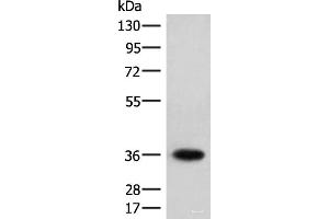 Western blot analysis of Jurkat cell lysate using HOXC12 Polyclonal Antibody at dilution of 1:500 (HOXC12 抗体)