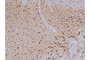 ABIN6267324 at 1/200 staining Rat brain tissue sections by IHC-P. (Tyrosine Hydroxylase 抗体  (pSer19))