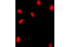 Immunofluorescent analysis of HOXA11/D11 staining in HeLa cells. (HOXA11/D11 抗体  (C-Term))