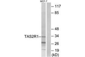 Western Blotting (WB) image for anti-Taste Receptor, Type 2, Member 1 (TAS2R1) (AA 6-55) antibody (ABIN2891095) (TAS2R1 抗体  (AA 6-55))