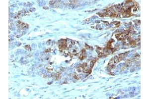 anti-Blood Group H antibody