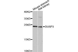Western blot analysis of extracts of various cell lines, using DUSP3 antibody (ABIN6290308) at 1:3000 dilution. (Dual Specificity Phosphatase 3 (DUSP3) 抗体)