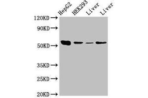 Western Blot Positive WB detected in: HepG2 whole cell lysate, HEK293 whole cell lysate, Rat liver tissue, Mouse liver tissue All lanes: MAP2K5 antibody at 3. (MAP2K5 抗体  (AA 1-190))