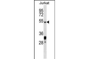 Western blot analysis in Jurkat cell line lysates (35ug/lane). (HSF5 抗体  (C-Term))