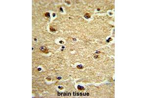 Formalin-fixed and paraffin-embedded human brain tissue reacted with CROT Antibody (N-term), which was peroxidase-conjugated to the secondary antibody, followed by DAB staining. (CROT 抗体  (N-Term))