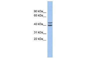 FBXL14 antibody used at 1 ug/ml to detect target protein. (FBXL14 抗体  (N-Term))