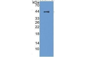 WB of Protein Standard: different control antibodies against Highly purified E. (Complement Factor H ELISA 试剂盒)