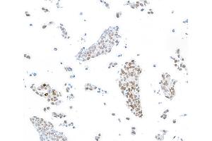 Immunocytochemistry (ICC) image for anti-Forkhead Box P1 (FOXP1) (AA 627-677) antibody (ABIN7454010) (Recombinant FOXP1 抗体  (AA 627-677))