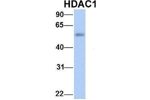 Host:  Rabbit  Target Name:  HDAC1  Sample Type:  Human Fetal Lung  Antibody Dilution:  1. (HDAC1 抗体  (Middle Region))