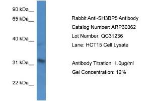 Western Blotting (WB) image for anti-SH3-Domain Binding Protein 5 (SH3BP5) (N-Term) antibody (ABIN2788423) (SH3BP5 抗体  (N-Term))