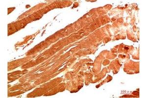 Immunohistochemical analysis of paraffin-embedded Human Skeletal Muscle Tissue using NBR1 Mouse mAb diluted at 1:200. (NBR1 抗体)