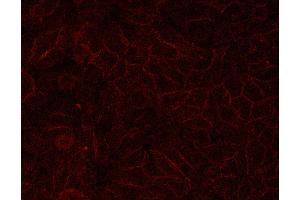 Immunohistochemistry (IHC) image for anti-Cadherin 1, Type 1, E-Cadherin (Epithelial) (CDH1) (C-Term) antibody (ABIN6261408)