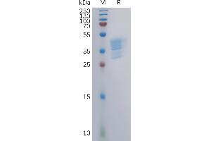 SDS-PAGE (SDS) image for Chemokine (C-C Motif) Receptor 4 (CCR4) (AA 1-39) protein (mFc Tag) (ABIN7491161)