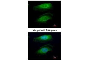 ICC/IF Image Immunofluorescence analysis of paraformaldehyde-fixed HeLa, using RICTOR, antibody at 1:200 dilution. (RICTOR 抗体  (C-Term))