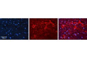 Rabbit Anti-ACP1 Antibody   Formalin Fixed Paraffin Embedded Tissue: Human heart Tissue Observed Staining: Extracellular Primary Antibody Concentration: N/A Other Working Concentrations: 1:600 Secondary Antibody: Donkey anti-Rabbit-Cy3 Secondary Antibody Concentration: 1:200 Magnification: 20X Exposure Time: 0. (ACP1 抗体  (Middle Region))