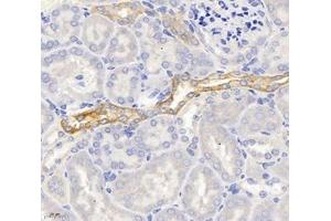Immunohistochemistry (Paraffin-embedded Sections) (IHC (p)) image for anti-Spectrin, Beta, Non-erythrocytic 2 (SPTBN2) antibody (ABIN7075698)