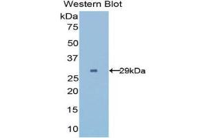 Western Blotting (WB) image for anti-UDP-Glucose Glycoprotein Glucosyltransferase 2 (UGT2) (AA 1221-1408) antibody (ABIN1176725)