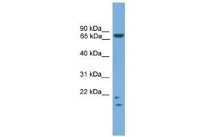 MRE11A antibody used at 0.