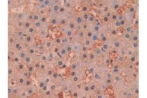 Detection of DDT in Human Liver Tissue using Polyclonal Antibody to D-Dopachrome Tautomerase (DDT) (DDT 抗体  (AA 2-118))