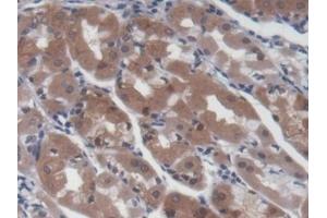 Detection of UCP2 in Human Stomach Tissue using Monoclonal Antibody to Mitochondrial Uncoupling Protein 2 (UCP2) (UCP2 抗体  (AA 154-289))