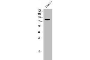 Western Blotting (WB) image for anti-General Transcription Factor IIH, Polypeptide 2, 44kDa (GTF2H2) (N-Term) antibody (ABIN7189036)