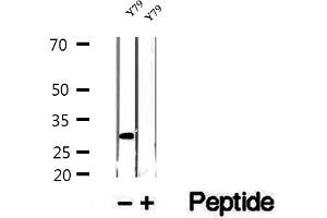 Western blot analysis of extracts of Y79 cells, using ETFA antibody. (ETFA 抗体  (Internal Region))