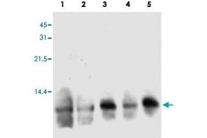 Western blot analysis of human S100A3 in hair extracts from 3 individual female. (S100A3 抗体)