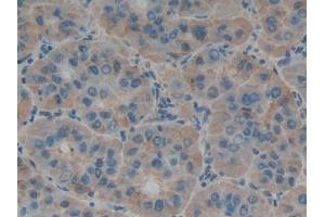 Immunohistochemistry (IHC) image for anti-Tumor Necrosis Factor (Ligand) Superfamily, Member 14 (TNFSF14) (AA 62-240) antibody (ABIN7436990)