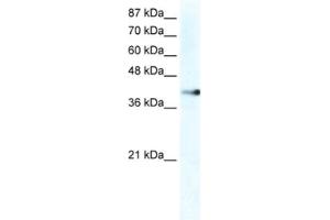 Western Blotting (WB) image for anti-Zinc Finger Protein 556 (ZNF556) antibody (ABIN2461276) (ZNF556 抗体)