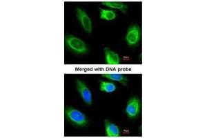 ICC/IF Image Immunofluorescence analysis of paraformaldehyde-fixed HeLa, using glycerol kinase 2, antibody at 1:200 dilution. (GK2 抗体)