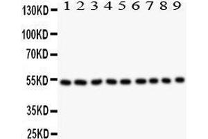 Western Blotting (WB) image for anti-Desmin (DES) (AA 1-304) antibody (ABIN3043265) (Desmin 抗体  (AA 1-304))