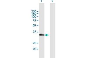 Western Blot analysis of SLC12A7 expression in transfected 293T cell line by SLC12A7 MaxPab polyclonal antibody. (SLC12A7 抗体  (AA 1-266))
