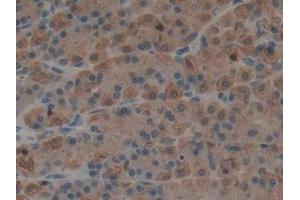 DAB staining on IHC-P; Samples: Rat Stomach Tissue (Epiregulin 抗体  (AA 1-162))