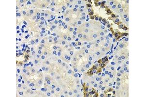 Immunohistochemistry of paraffin-embedded Mouse kidney using CALB2 Polyclonal Antibody at dilution of 1:100 (40x lens). (Calretinin 抗体)