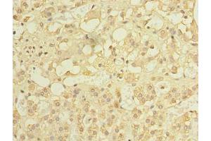 Immunohistochemistry of paraffin-embedded human adrenal gland tissue using ABIN7150185 at dilution of 1: 100 (MCM9 抗体  (AA 1-391))